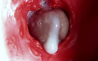 Mini-camera In the Butthole: Intense Anal Orgasm With a Creampie Is Shown From the Inside